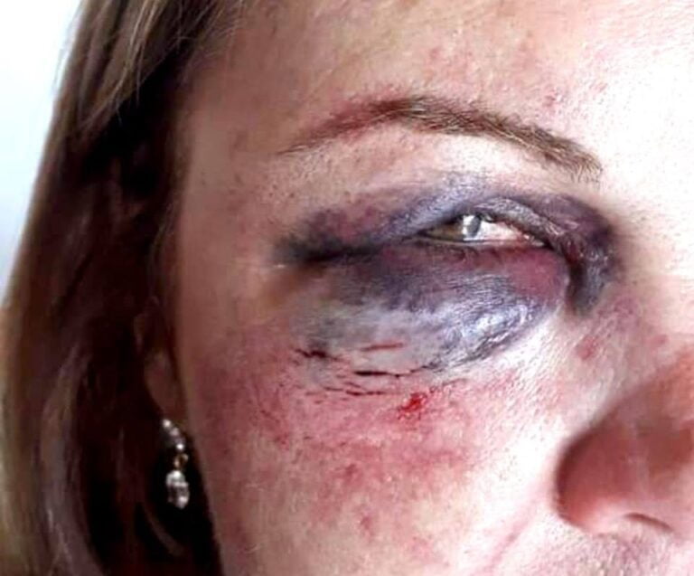 VIOLÊNCIA – Polícia apreende adolescentes que roubaram e espancaram taxista em São Manuel  Dois adolescentes com v