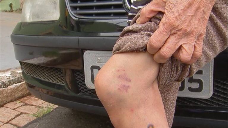 JUDIAÇÃO – “Fiquei tremendo mais de uma hora”, conta idosa agredida por falsos instaladores de antena digital em Marília