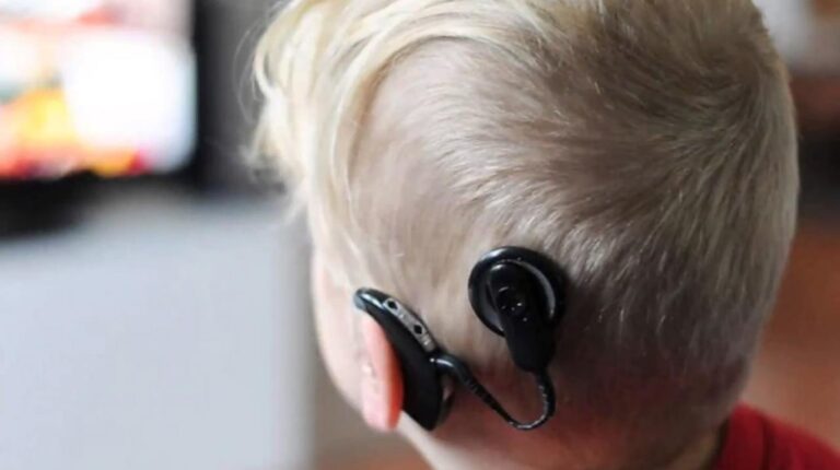 Boa notícia – IMPLANTES COCLEARES BILATERAIS SERÃO FEITOS PELO HCFAMEMA