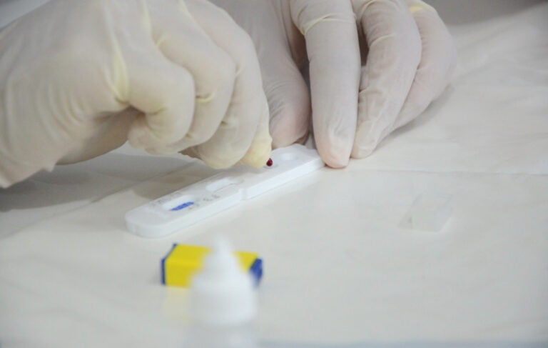 Pandemia – PESQUISA REALIZA 250 TESTES PARA COVID-19 EM MARÍLIA