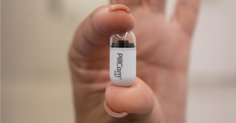 SAÚDE INTESTINAL ENTRA EM NOVA ERA EM JAÚ: UNIMED REALIZA PRIMEIRO EXAME COM CÁPSULA ENDOSCÓPICA